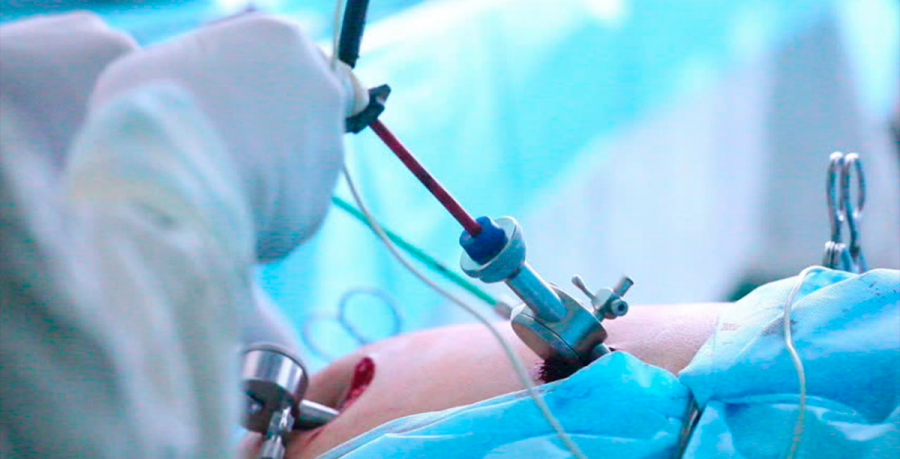 Cirurgia Bariátrica por Videolaparoscopia  