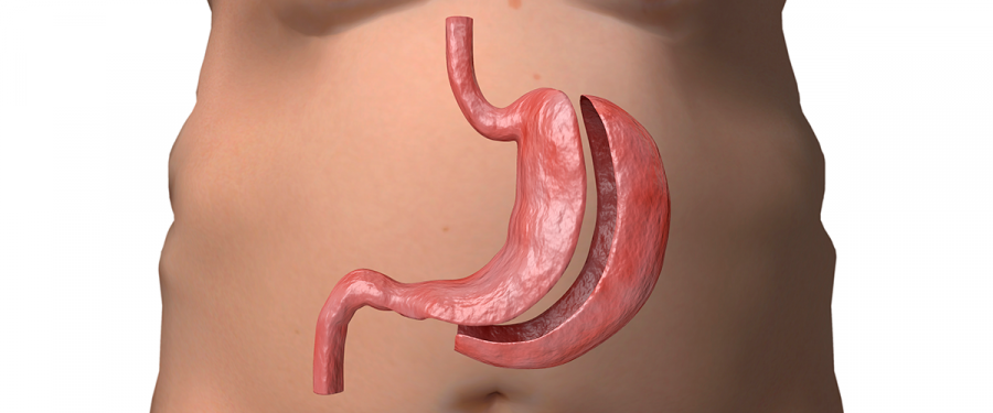 Cirurgia Revisional: quando ela pode ser indicada? Cirurgia Revisional: quando ela pode ser indicada?